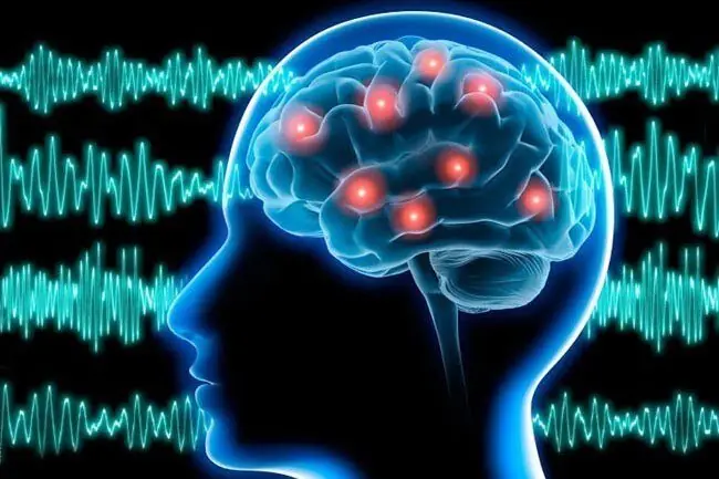 چین از نخستین سامانه MRI جهان برای خواندن شبکههای مغزی رونمایی کرد