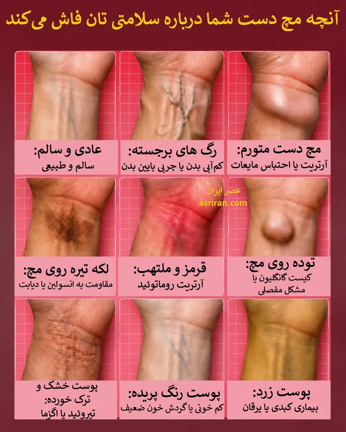  وقتی مچ دست شما هشدار می‌دهد