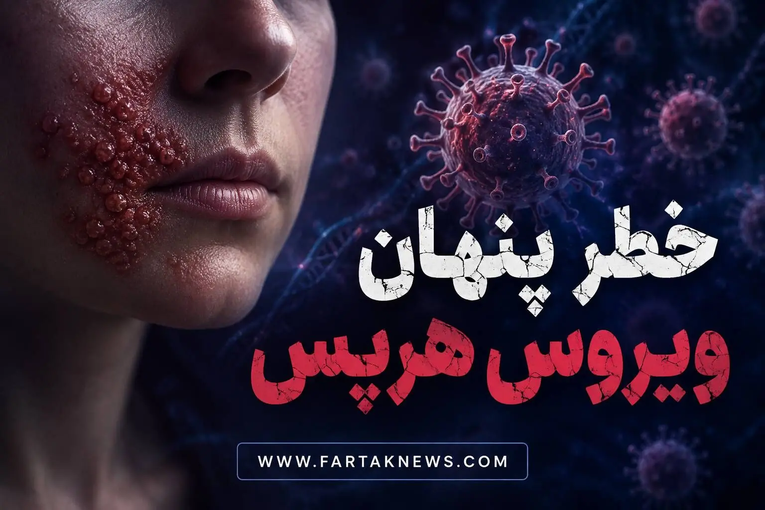 خطر پنهان ویروس هرپس؛ از تاولهای دردناک تا انتقال بیماری بدون هیچ علامت ظاهری!