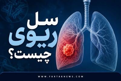 خطر بازگشت یک قاتل باستانی؛ از سرفههای ۳ هفتهای تا تعریق شبانه و خلط خونی با بیماری سل!