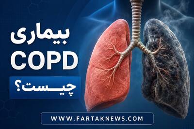 بیماری COPD چیست؟ علائم و عوامل خطر بیماری انسدادی مزمن ریه