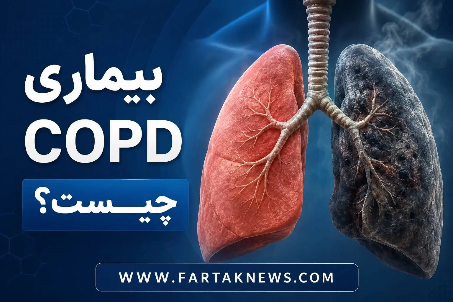بیماری COPD چیست؟ علائم و عوامل خطر بیماری انسدادی مزمن ریه