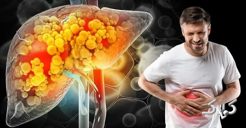  بالاخره با کبد چرب تخم‌مرغ بخوریم یا نه؟ - مجله اینترنتی کولاک