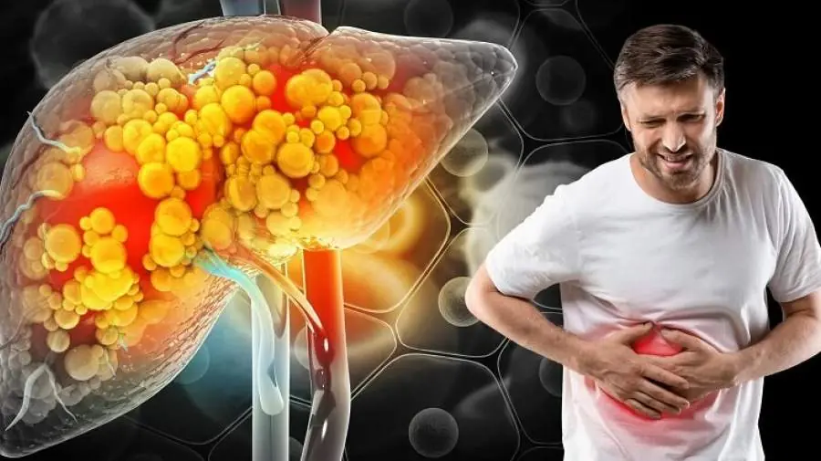 میگنا - بالاخره با کبد چرب تخممرغ بخوریم یا نه؟