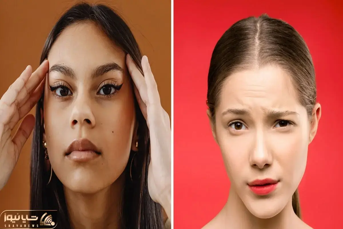 چطور طبیعی خط اخم را محو کنیم؟ یک هزارم هزینه بوتاکس خرج کنید همان نتیجه را بگیرید