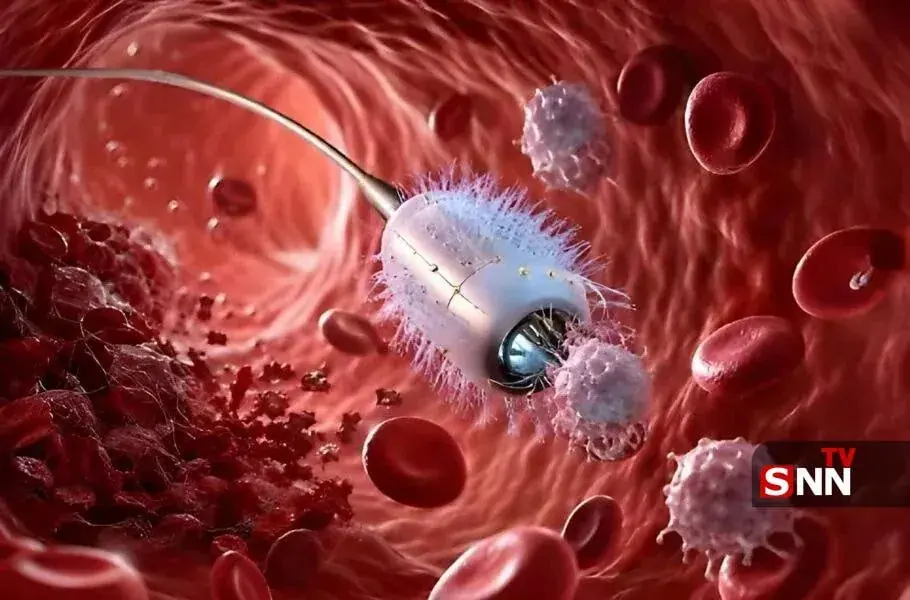 شکار سلولهای سرطانی با ربات مویی شکل