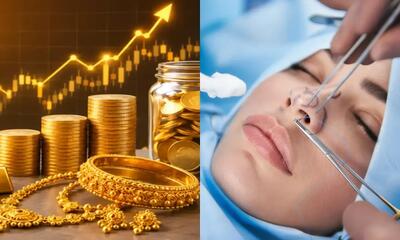  نوسان بازار طلا، هزینه جراحی بینی را چقدر جابه‌جا کرد؟
