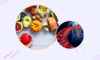 برای بهبود گردش خون چه بخوریم؟ این خوراکیها را بشناسید