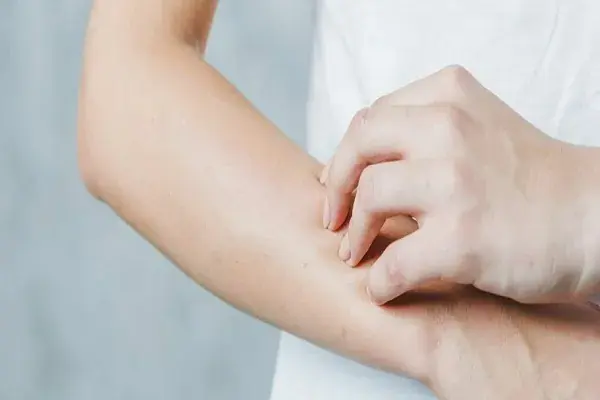 علت خارش بدن در شب چیست؟ بررسی کامل دلایل، از تغییرات طبیعی تا بیماریهای جدی + راهکارهای درمانی