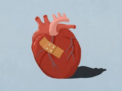  یک معیار جدید برای تشخیص سندرم قلب شکسته