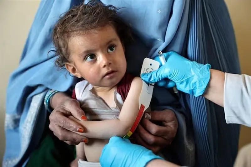  سازمان ملل: 100 مرکز درمان سوءتغذیه کودکان در افغانستان تعطیل شد - تسنیم
