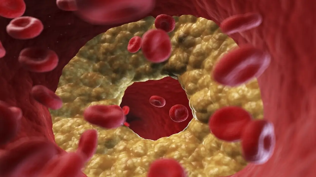 یک رژیم غذایی محبوب که باعث افزایش خطرناک کلسترول شود