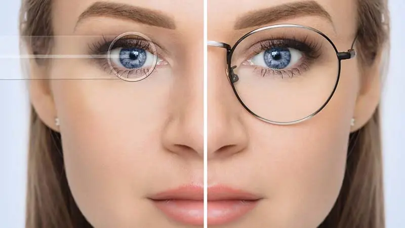 بهترین جراح حذف عینک چه ویژگیهایی دارد؟ راهنمای انتخاب پزشک متخصص