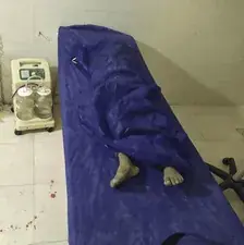  تصویر دردناک کودکی که آمریکا دیشب او را در عروسی به شهادت رساند