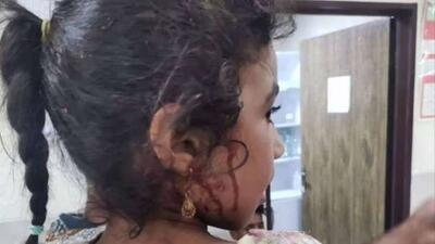 حمله به مراسم عروسی در هرمزگان از مجاری بینالمللی پیگیری میشود