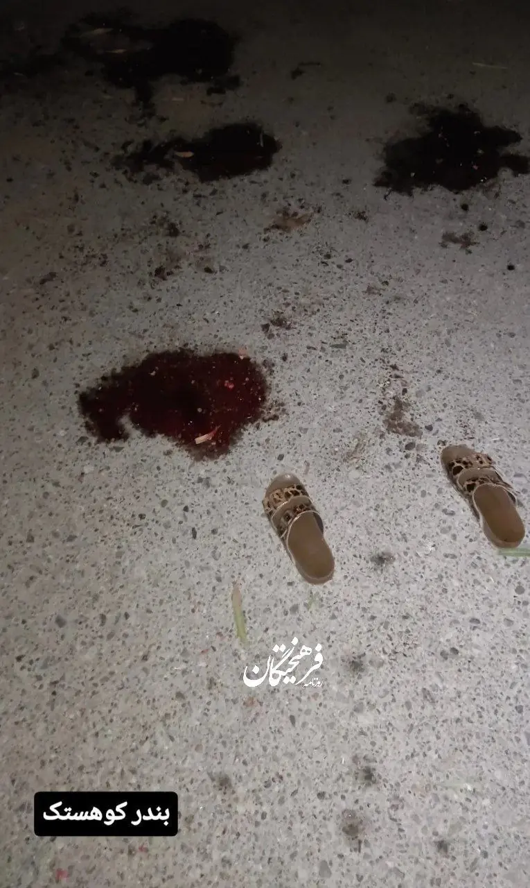  تصویر تلخ از جنایت آمریکا در مراسم عروسی