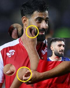 عکس/ ناخن‌های حسین کنعانی‌زادگان در بازی دیشب جنجالی شد