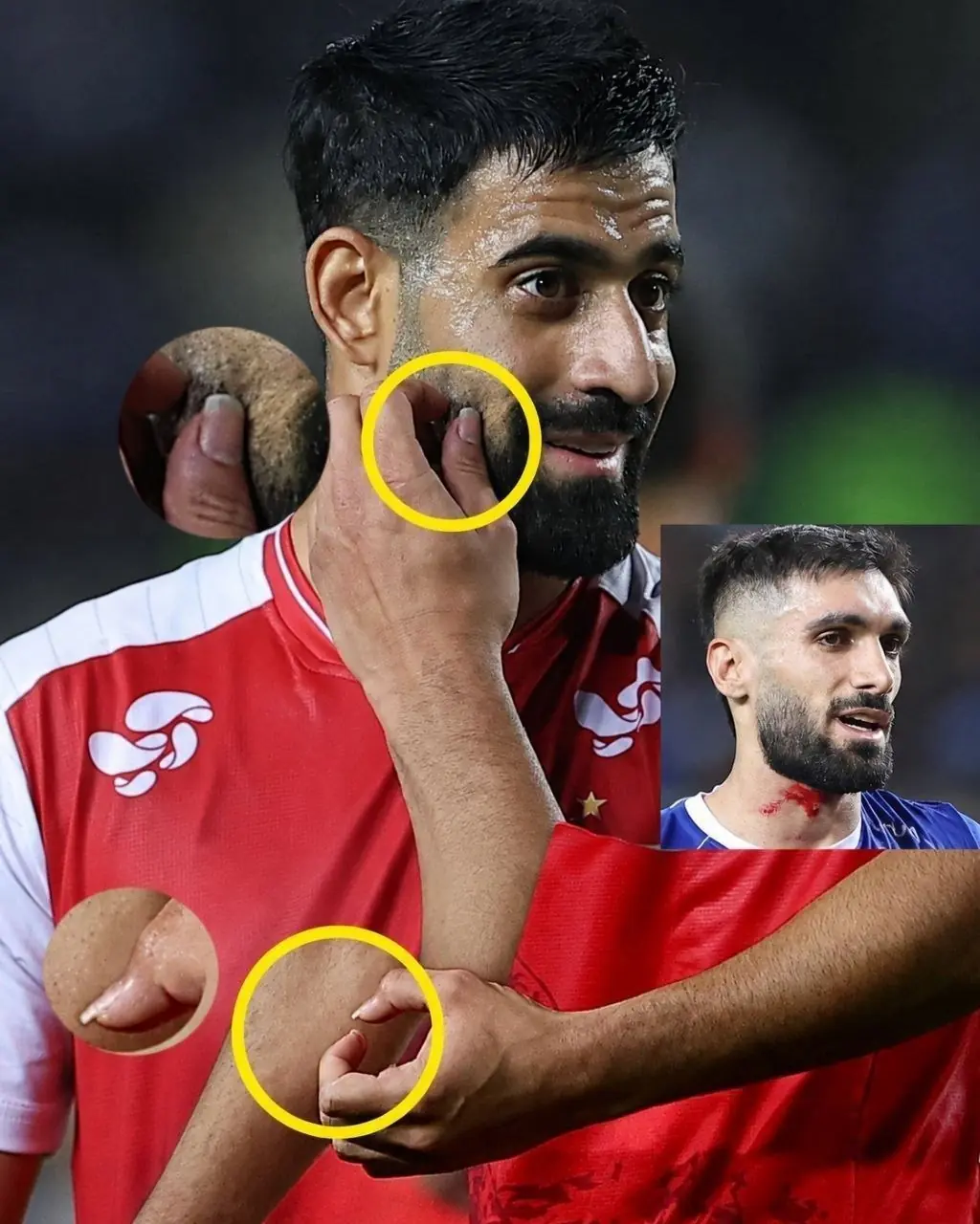 عکس/ ناخنهای حسین کنعانیزادگان در بازی دیشب جنجالی شد