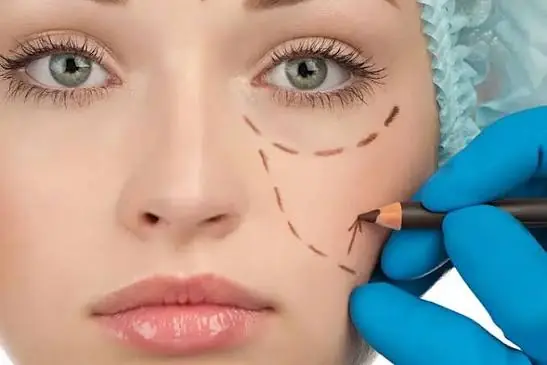 بلفاروپلاستی پلک پایین بدون برش چیست و برای چه کسانی مناسب است؟