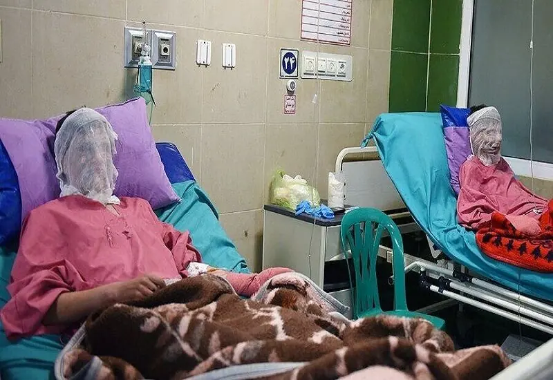 سوختگی در صدر حوادث غیرعمد خراسان جنوبی است