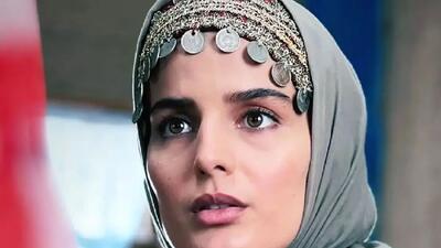 گذر زمان /عکس چهره «غزاله اکرمی» بازیگر نقش سوجان بعد 2 سال و در ترکیه