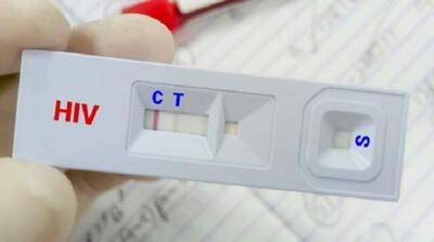  کاهش سهم «اعتیاد» در انتقال HIV - مردم سالاری آنلاین