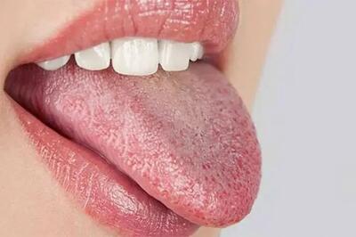 رنگ زبان شما چه هشداری درباره سلامت بدنتان میدهد؟