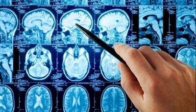  افزایش امنیت هوش مصنوعی در تحلیل MRI مغز با راه حل پژوهشگران دانشگاهی | آخرین خبر