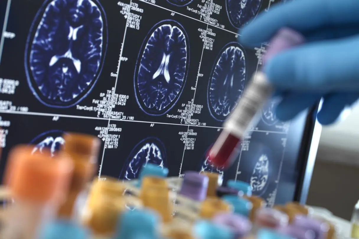 هوش مصنوعی ممکن است در تشخیص سرطان بهتر عمل کند!