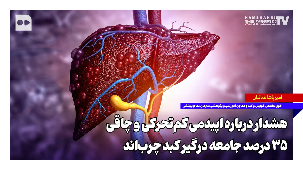 هشدار درباره اپیدمی کمتحرکی و چاقی؛ ۳۵ درصد جامعه درگیر کبد چرباند