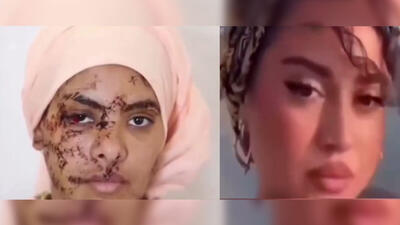 فیلم 130 بخیه بر صورت و دستان زن جوان /  شوهر سابقش صورت زیبای او را با چاقو خط خطی کرد
