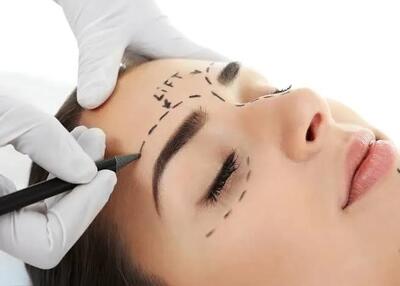  لیفت پیشانی و شقیقه برای جوانسازی صورت؛ چه تغییراتی ایجاد می‌کند؟