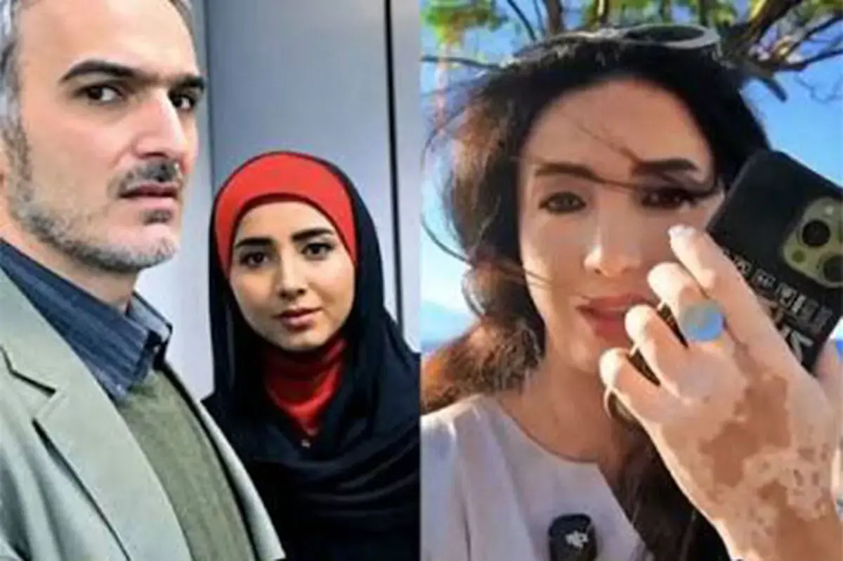  درددل بازیگر ساختمان پزشکان؛ «گفتند ویتیلیگو گرفتی»
