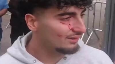 لحظات زد و خورد وحشیانه ضدانقلاب مقابل سازمان ملل