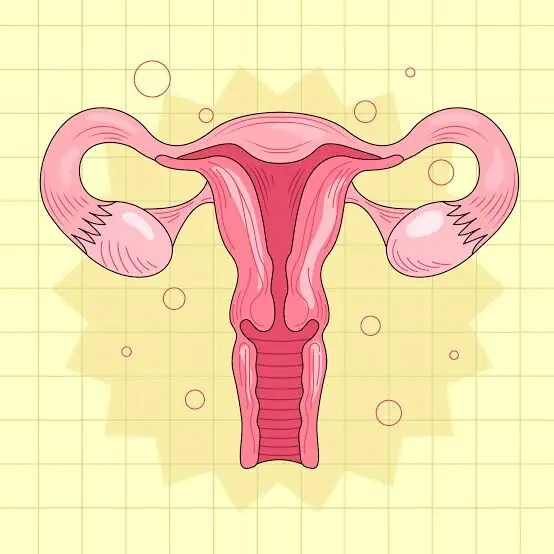 اختلال کف لگن باعث ناباروری میشود؟
