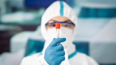  شیوع طاعون در روسیه؛ مراجع رسمی تاییدش کرده اند؟