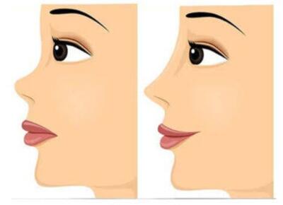  جراح بینی عروسکی در شیراز، معرفی لیست منتخب + ویژگی‌ها و نمونه کارها