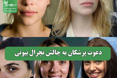  دعوت پزشکان به چالش نچرال بیوتی