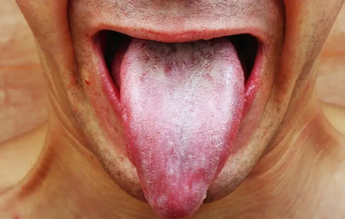  وقتی زبان علامت هشدار می‌دهد