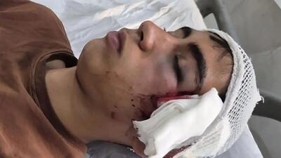  معلمی که با دسته صندلی به دانش آموز حمله کرده بود تعلیق شد / ورود دادستان بم به پرونده