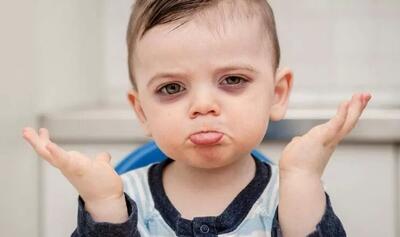  تیرگی زیر چشم کودکان نشانه چیست ؛ کم‌خونی، حساسیت یا ارثی؟