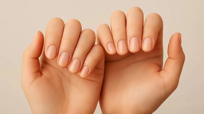  شکل و ظاهر ناخن شما درباره سلامتی چه می‌گوید؟