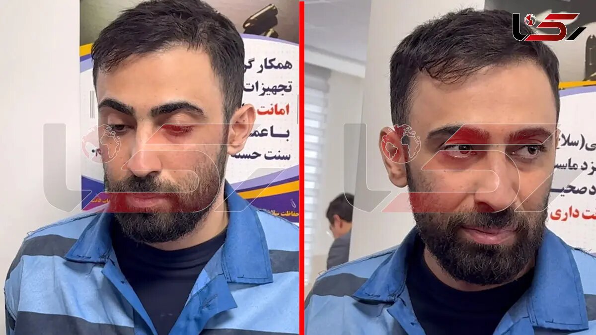 اشک‌های تلخ یکی از شکات جراح قلابی