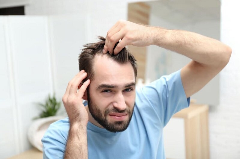 خداحافظی با طاسی؛ کشف داروی جدید | الگوی طاسی مردانه چگونه است؟