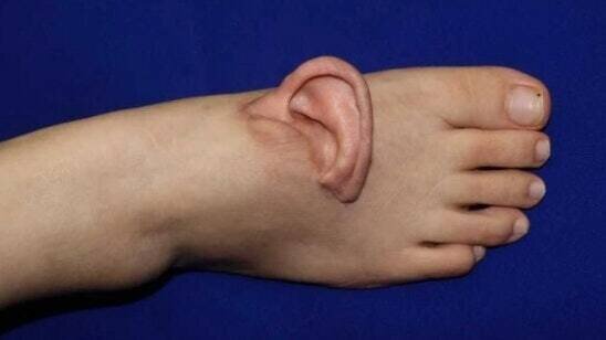 گوش چپ روی پای راست!