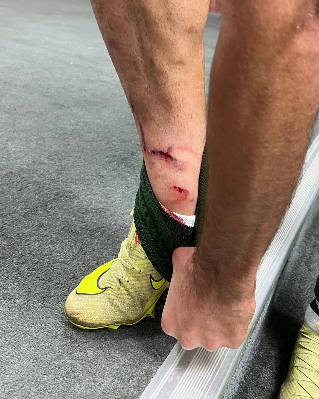 بیانیه در بین دو نیمه؛ اعتراض آلومینیوم به اخراج نشدن سرلک(عکس)