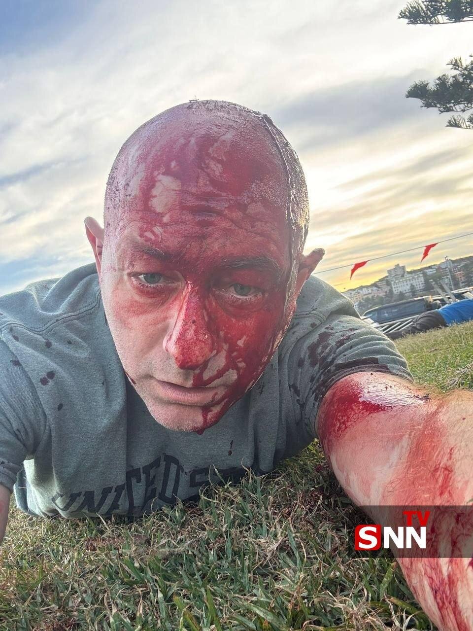 ماجرای تیراندازی در جشن مذهبی یهودیان در استرالیا چه بود؟ / هلاکت دست کم ۱۰ صهیونیست در جشن حانوکا