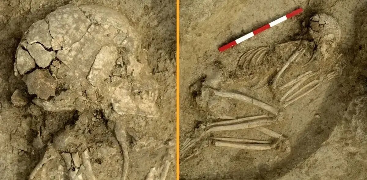 فرو رفتن دندان شیر در جمجمه یک نوجوان + عکس | اسکلت ۶ هزار سال قبل را ببینید