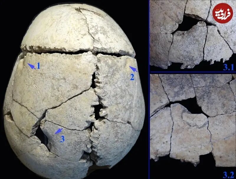 فرو رفتن دندان شیر در جمجمه یک نوجوان + عکس | اسکلت ۶ هزار سال قبل را ببینید
