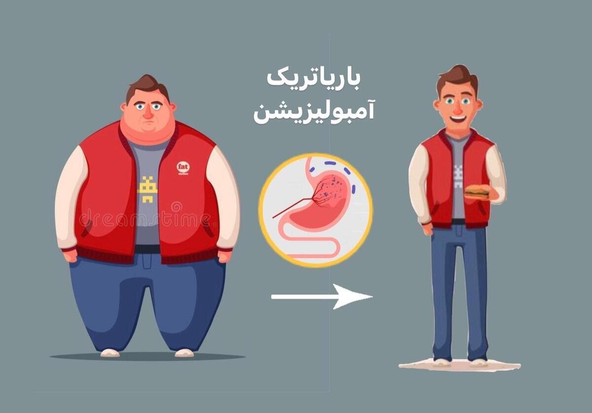 بستن رگ اشتها؛ روش بدون سند علمی و پرخطر برای بیماران چاق/ خطری در کمین بیماران چاق با بستن رگ اشتها